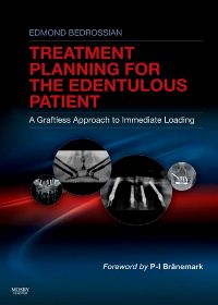 Implant Treatment Planning for the Edentulous Patient