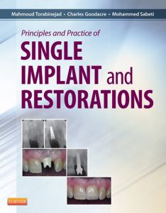 Principles and Practice of Single Implant and Restoration