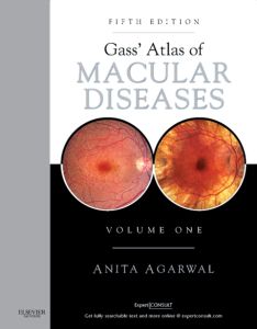Gass' Atlas of Macular Diseases