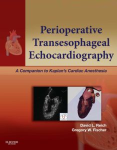 Perioperative Transesophageal Echocardiography