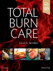 Total Burn Care