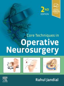 Core Techniques in Operative Neurosurgery