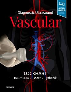 Diagnostic Ultrasound: Vascular