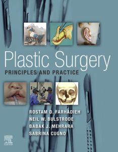 Plastic Surgery - Principles and Practice