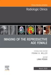 Imaging of the Reproductive Age Female,An Issue of Radiologic Clinics of North America