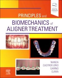 Principles and Biomechanics of Aligner Treatment