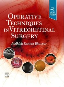 Operative Techniques in Vitreoretinal Surgery