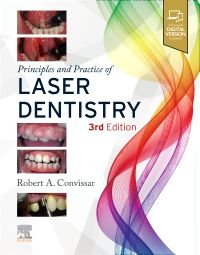 Principles and Practice of Laser Dentistry