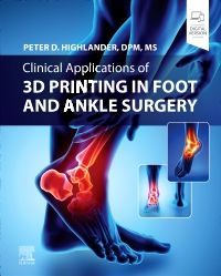 Clinical Application of 3D Printing in Foot & Ankle Surgery