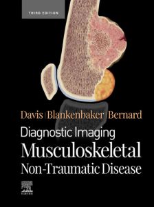 Diagnostic Imaging: Musculoskeletal Non-Traumatic Disease