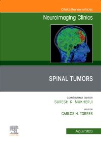 Spinal Tumors, An Issue of Neuroimaging Clinics of North America, E-Book
