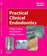 Practical Clinical Endodontics