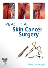 Practical Skin Cancer Surgery