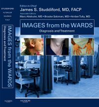 Images from the Wards: Diagnosis and Treatment