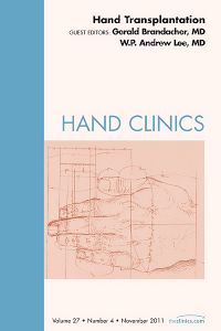 Hand Transplantation, An Issue of Hand Clinics