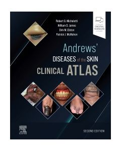 Andrews' Diseases of the Skin Clinical Atlas