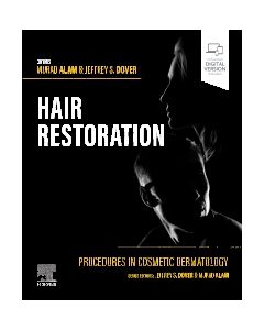 Procedures in Cosmetic Dermatology: Hair Restoration