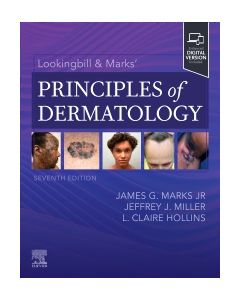 Lookingbill & Marks’ Principles of Dermatology